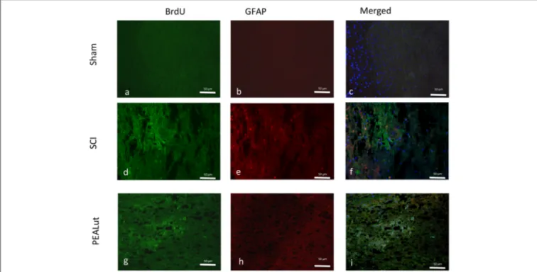 FIGURE 5 | Effect of co-ultraPEALut on co-localization of BrdU/GFAP after SCI. Results are shown for (A–C) sham-operated mice, (D–F) mice with SCI, and (G–I) mice with SCI treated with co-ultraPEALut