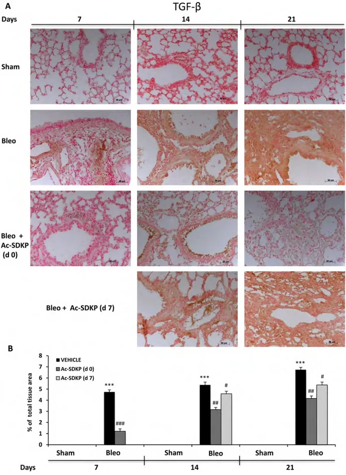 Figure  7: Ac-SDKP  treatment  inhibited  BLEO-induced  TGF-β  expression  in  mouse  lung  tissue