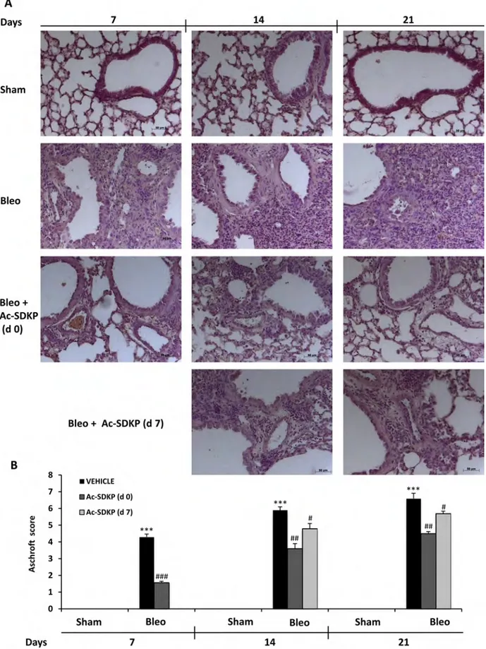 Figure 3: Ac-SDKP treatment suppressed BLEO-induced histological  marks of lung damage and fibrosis  in mouse  lung