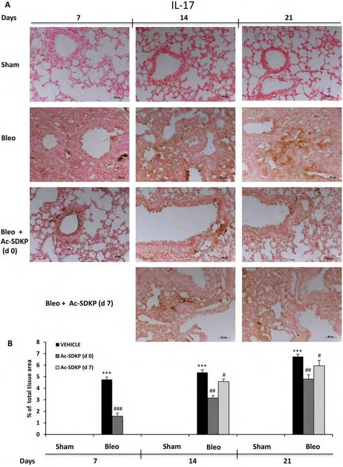 Figure  6:  Ac-SDKP  treatment  inhibited  BLEO-induced  IL-17  expression  in  mouse  lung  tissue