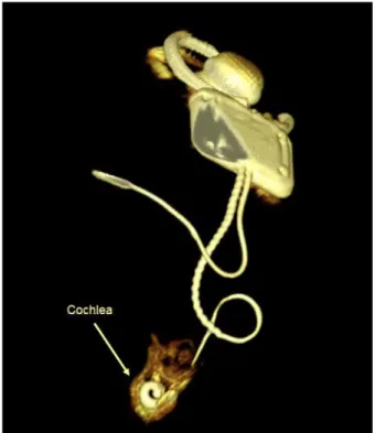 Figure 1.   3D imaging excluded malposition of the electrode.