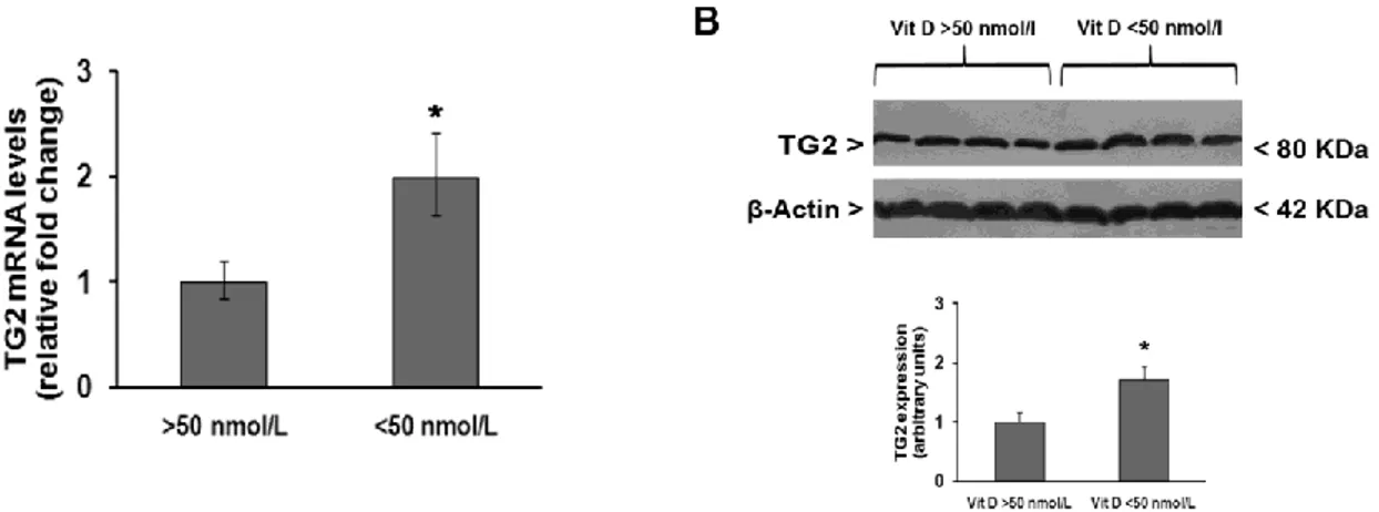 Figure  1.  Changes  in  transglutaminase  2  (TG2)  expression  in  peripheral  blood  mononuclear  cells 
