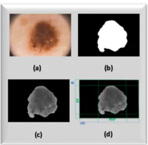 Figure 4. (a) Original RGB dermoscopy image, (b) image-mask provided by PH 2  database, (c) SC-