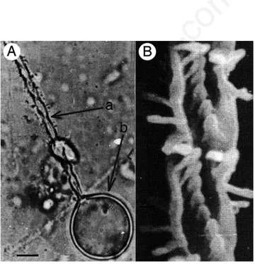 Figure 3. Discharged nematocyst of Pelagia noctiluca (A), and par- par-ticular of the discharged filament (B)