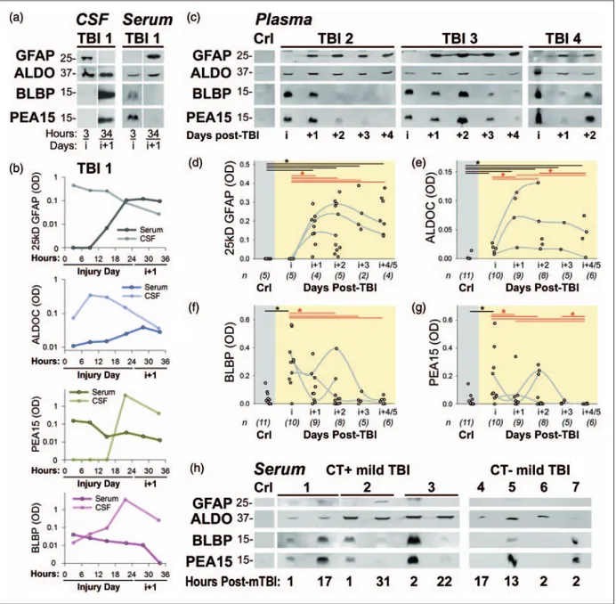 Figure 4. AID biomarkers appear hyper-acute and robust in blood of severe and mild TBI patients