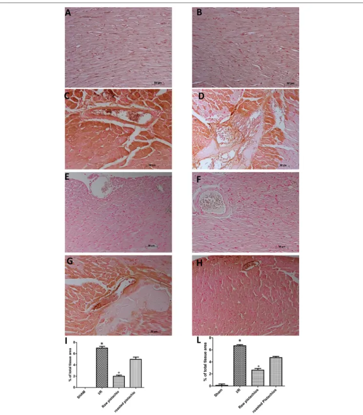 FIGURE 5 | Effect of pistachios on adhesion molecules expression. Immunohistochemical analysis of myocardial sections obtained from STZ rats subjected to myocardial ischemia/reperfusion revealed a positive staining for ICAM-1 (C) and P-selectin (D) in the 