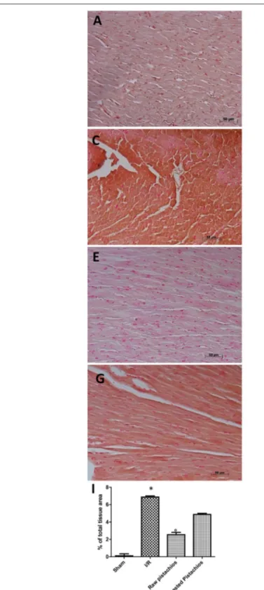 FIGURE 6 | Effect of pistachios on nitrotyrosine and PAR. Immunohistochemistry for nitrotyrosine (C) and PAR (D) showed positive staining in the heart tissue section from STZ-I/R -treated rats, compared to the sham treated animals (A,B)