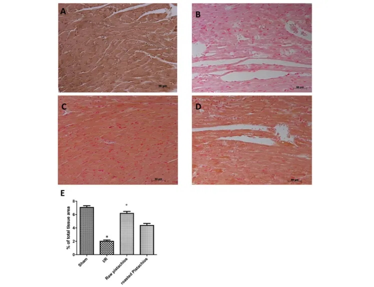 FIGURE 8 | Effect of pistachios treatments Bcl-2 expression. Heart tissues collected from sham treated animals displayed basal expression of Bcl-2 (A), while Bcl-2 expression was significantly reduced in the heart tissues from I/R-treated rats (B)