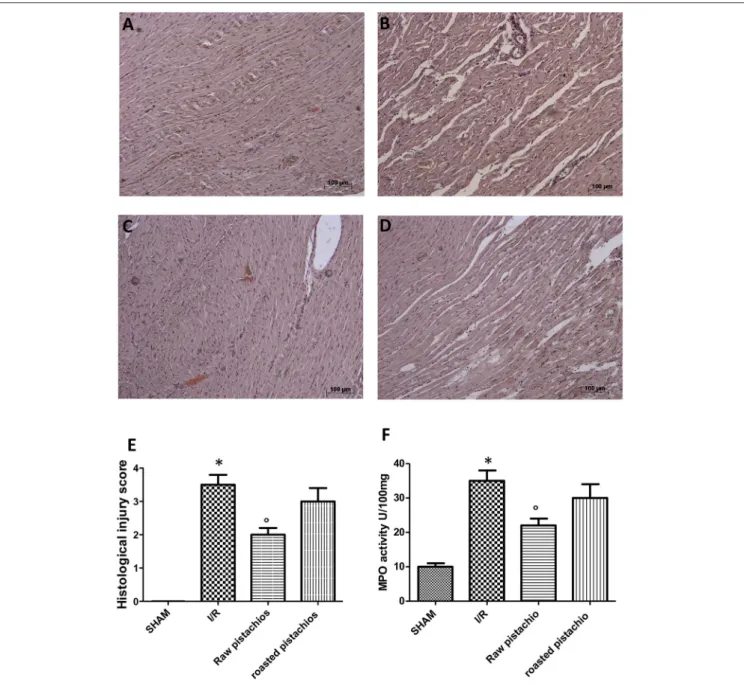 FIGURE 2 | Effect of pistachios on ischemia-reperfusion injury. Histological examination (haematoxylin/eosin staining) showed tissue damage, necrosis with massive neutrophil infiltration in ischemic reperfused-heart (B) compared to sham rats whose histolog