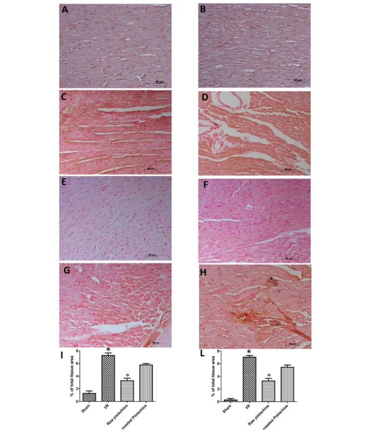 FIGURE 3 | Effect of pistachios on cytokines production. The inflammatory response includes the expression of cytokines in the late stage of reperfusion