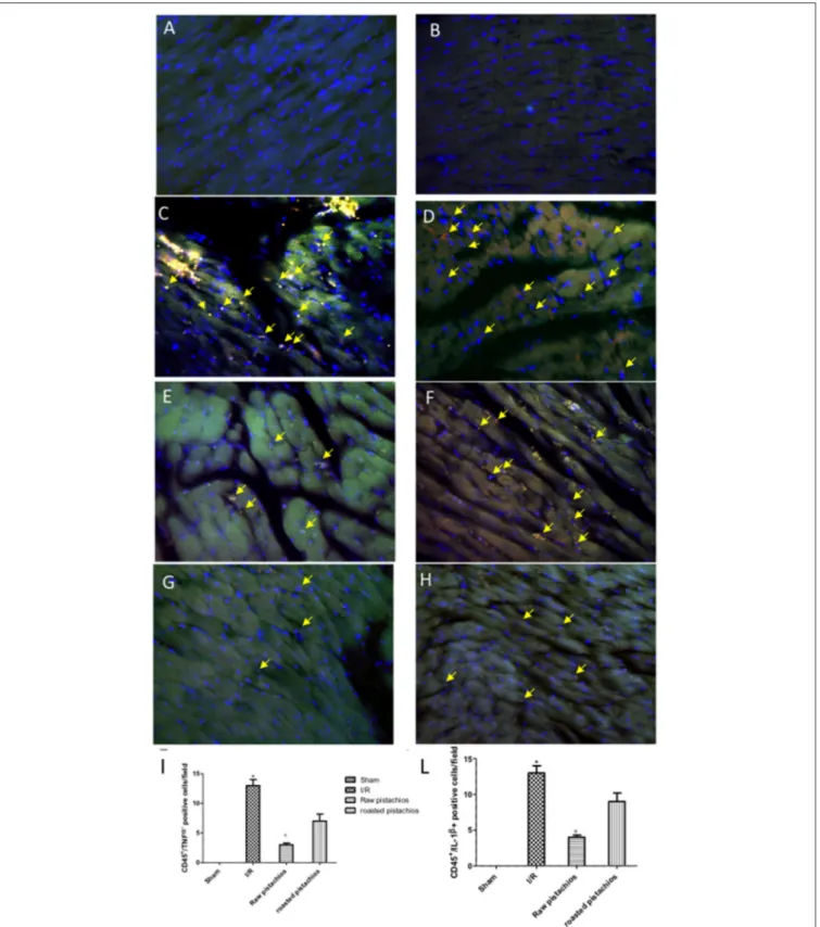 FIGURE 4 | Effect of pistachios on cytokines co-localization with inflammatory cell marker