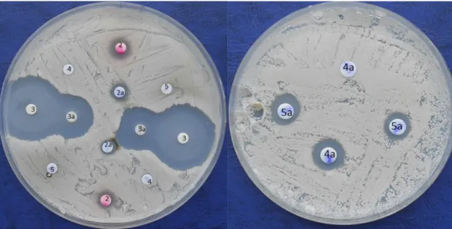 Figure S2. Anti-micograms carried out with the strain Aureobasidium sp. MC 875 in 2 Petri dishes of different size: on the left, the 