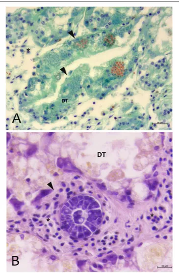 FIGURE 3 | Parasites observed in Campania (A) and Sardinia samples (B) of P. nobilis. (A) Digestive gland of Pinna nobilis infected with by H
