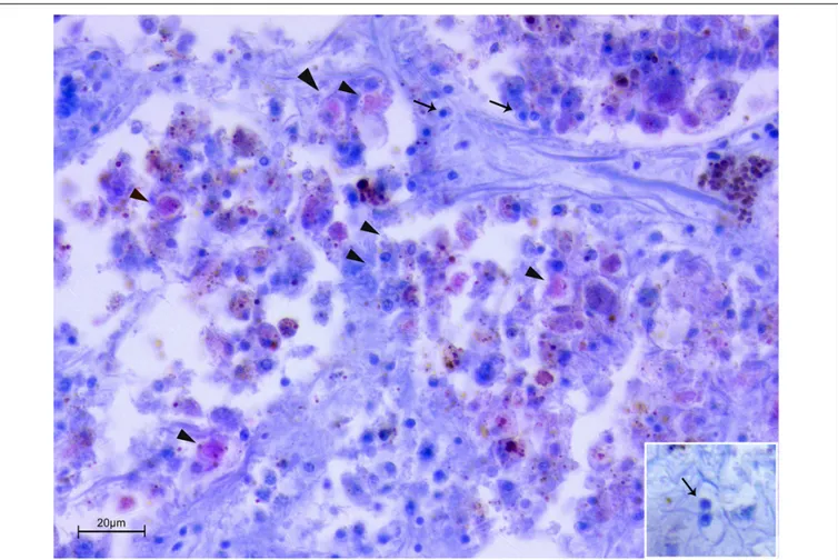 FIGURE 4 | Co-infection by Mycobacterium sp. and H. pinnae in samples of P. nobilis from Catalunya (ZN stain)