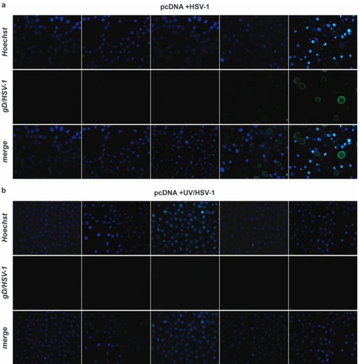 Figure 3 Immunofluorescence microscopy analysis of time-dependent expression of gD-HSV-1 in U937 cells infected with HSV-1 inactivated or not with UV irradiation