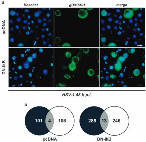 Figure 6 Simultaneous detection of apoptotic and gD/HSV-1-positive cells by immunofluorescence analysis of HSV-1-infected U937-pcDNA and U937-DN-I κB cells