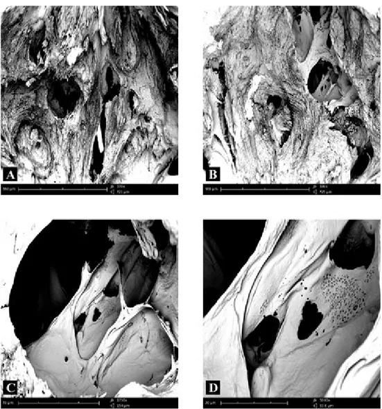 Figure 5 – Compound panel of fracture surfaces of sub-cortical zone of bone tissue from a biopsy of  femo-