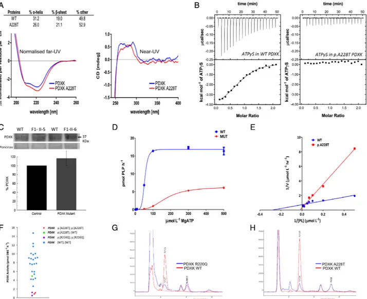 FIGURE 3: PDXK mutations lead to reduced pyridoxal (PL) kinase enzymatic activity and low PL 5 0 -phosphate (PLP)