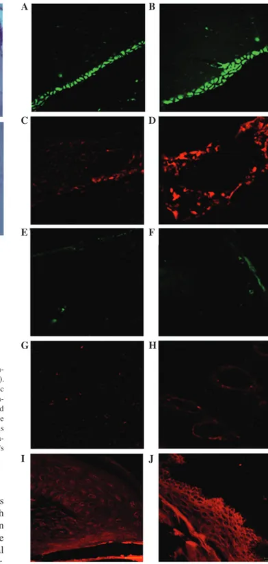 Figure 3. Hematoxilin and eosin staining of the rat mandibular bone and gin- gin-gival epithelium following 30-45 days of zoledronate treatment (0.1 mg/kg)