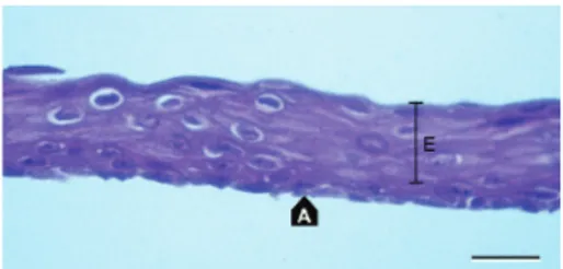 Figure 1: Cultivated oral epithelium (E) on the amniotic membrane
