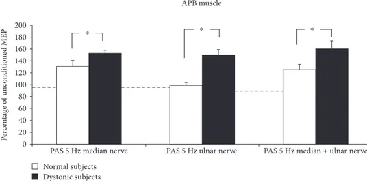 Figure 2: 5 Hz rPAS induced an increase in MEP size recorded from ADM muscle in both patients and controls; repeated measure ANOVA showed a signi ﬁcant eﬀect of time [F = 89 22; P &lt; 0 001] and time × group interaction [F = 29 73; P &lt; 0 001].