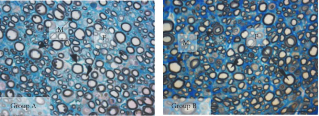 Figure 4: Representative high-resolution (40x) light microscopy images of toluidine-blue stained semithin transverse sections of regenerated median nerve repaired with end-to-end nerve suture, with (Group A) or without (Group B) a conduit of collagen matri