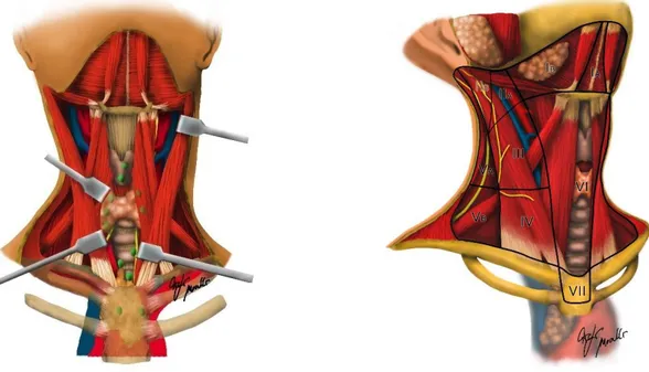 Figure 2.  Midline group  of  cervical  nodes  (Levels  VI  and  VII).  Level  VI:  It  is  the  frontmost  level,  located  between  carotid  arteries,  hyoid  bone  superiorly  and  sternum  inferiorly