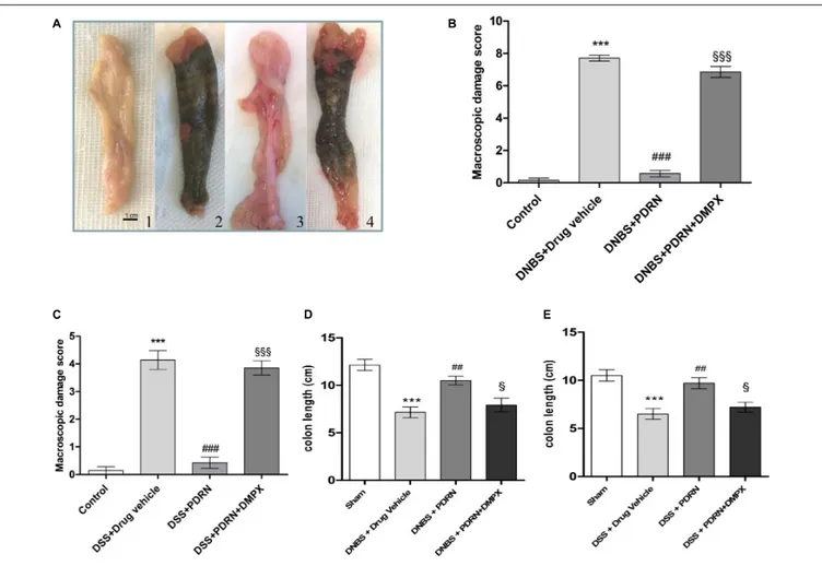 FIGURE 2 | Macroscopic evaluations. Colons (A) from control (1), DNBS+drug vehicle (2), DNBS+PDRN (3), DNBS+PDRN+DMPX (4) are depicted