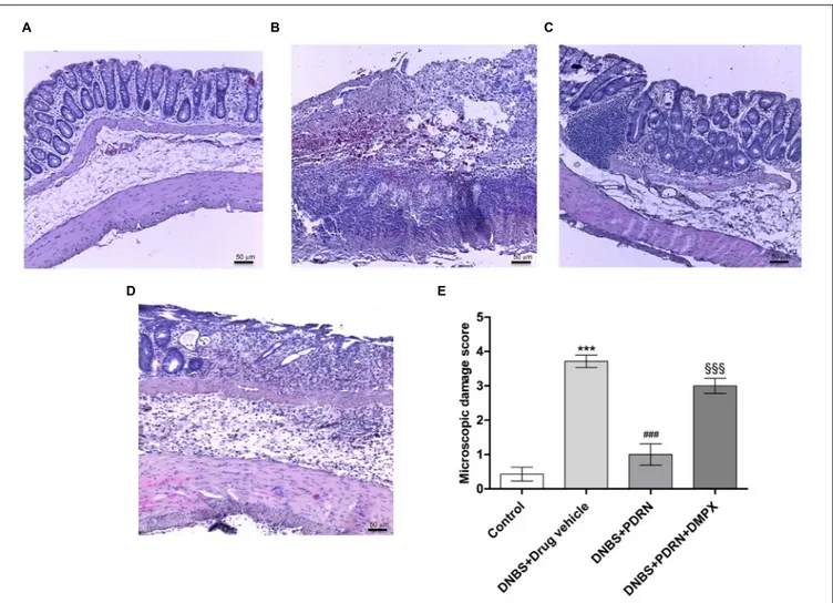 FIGURE 3 | Histological evaluations from DNBS-treated animals. Representative photomicrographs of H&amp;E stained tissues (original magnification 10×) derived from control (A), DNBS+drug vehicle (B), DNBS+PDRN (C), or DNBS+PDRN+DMPX (D) animals are shown