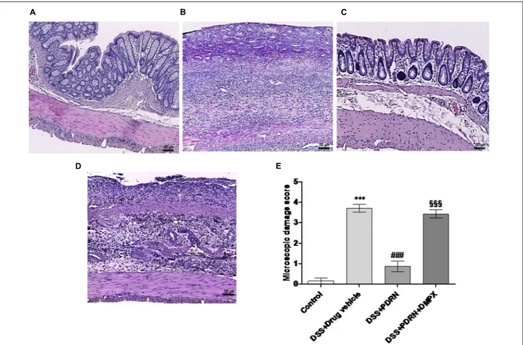 FIGURE 4 | Histological evaluations from DSS-treated animals. Representative H&amp;E images (original magnification 10×) of tissues derived from control (A), DSS+drug vehicle (B), DSS+PDRN (C), or DSS+PDRN+DMPX (D) treated animals are shown here