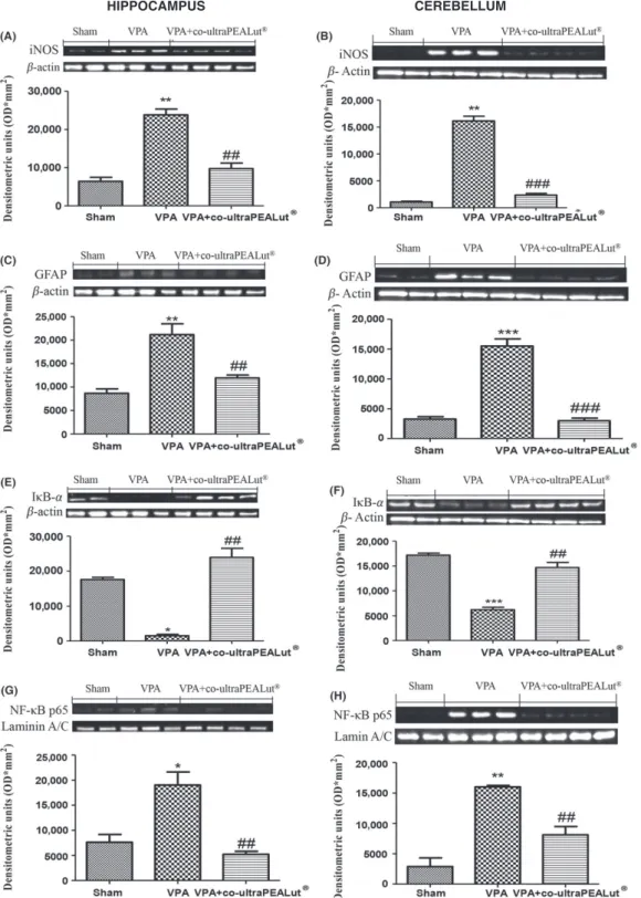 Figure 2 Effect of co-ultramicronized PEA-LUT  administration on inflammatory markers in VPA-treated mice