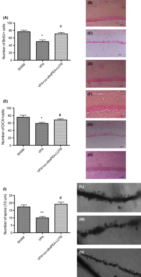 Figure 5 Cell proliferation, dendritic maturation, and synaptic plasticity in the dentate gyrus of mouse hippocampus: effect of VPA treatment and co-ultramicronized  PEA-LUT 