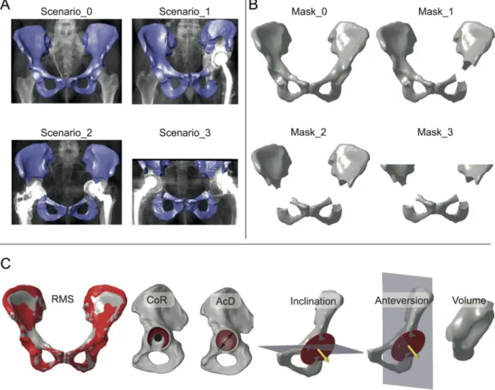 Figure 4. Validation of the statistical shape model. The validation comprises a Leave-one-out study representing four clinical scenarios (Scenario_0, Scenario_1, Scenario_2, Scenario_3) by four masks (Mask_0, Mask_1, Mask_2, Mask_3) and comparing six anato