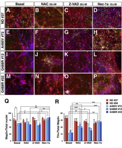 Figure 6. PD-OPA1 NPCs Have a Reduced Neuronal Differentiation Potential