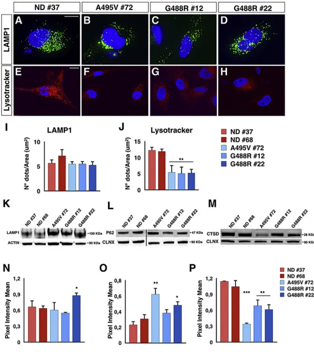 Figure 5. Lysosomal Activity Impairment in PD-OPA1 NPCs