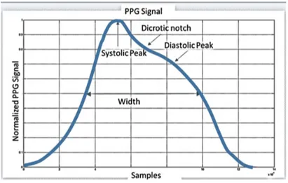 Figure 1. Compliant standard PPG waveform. 