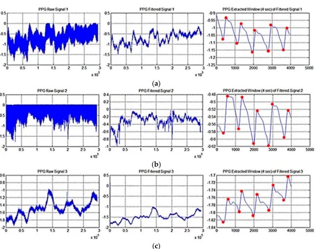 Figure 6. (a) The plot in the first column reports the PPG Raw Signal 1 (left wrist). The second window  reports same PPG raw signal filtered as per FIR filters previously described