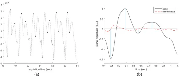 Figure 7. Representative results of FD Analysis (b) of the PPG signal (a). The analysis of the FD of  the PPG signal allows the detection of the maximum and minimum points of the timeseries