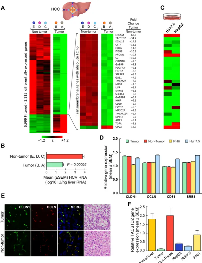 Fig 1. Gene expression profiling and HCV RNA in tumor and nontumorous liver tissue of patients with HCV-associated HCC