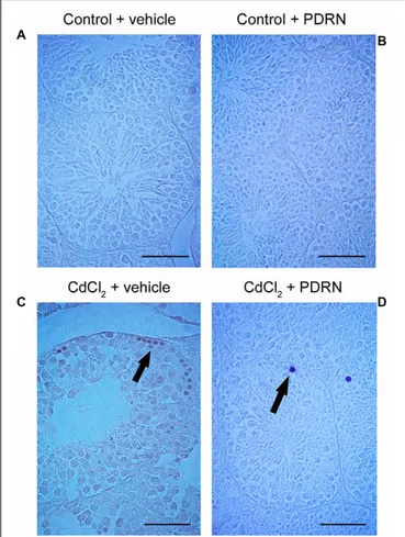 FIGURE 5 | Trypan blue staining technique revealing interstitial macrophages in the testes from control plus vehicle animals (A), control plus PDRN (8 mg/kg i.p.) animals (B), CdCl 2 (2 mg/kg i.p.) plus vehicle