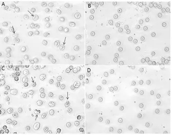 Fig 6. Erythrocytes morphology under H 2 O 2 plus curcumin treatment. Light microscope observations