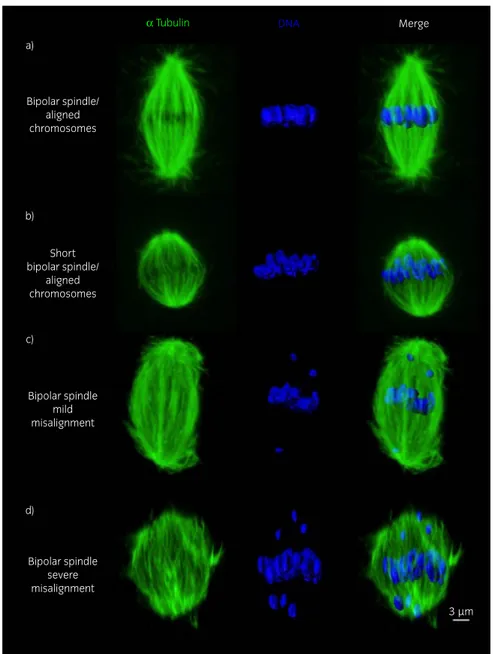 Fig 2: Representative images of a) a bipolar spindle with properly aligned chromosomes on the metaphase plate, from a young mare oocyte; b) bipolar spindle showing a reduced pole-to-pole length but with chromosomes properly aligned on the metaphase plate, 