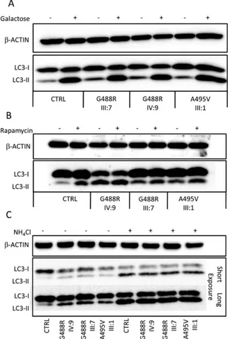 FIGURE 8: Autophagy in control and mutant fibroblasts. Representative immunoblots are shown, documenting the conversion of nonlipidated microtubule-associated protein 1 light chain 3 (LC3)-I to its cleaved and lipidated variant  LC3-II in skin fibroblasts 