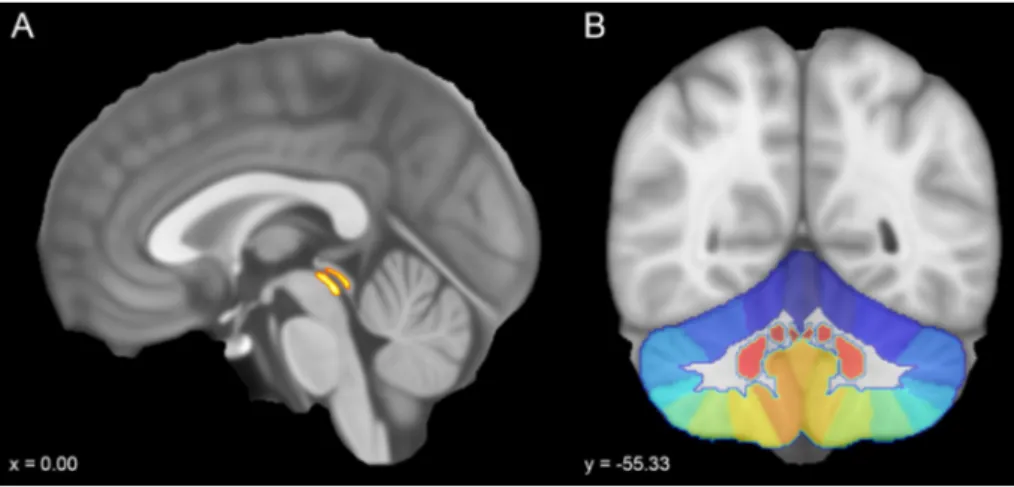 Fig. 1    Sagittal and coronal sec- sec-tions of the MNI152 template  (voxel size 0.5 mm)