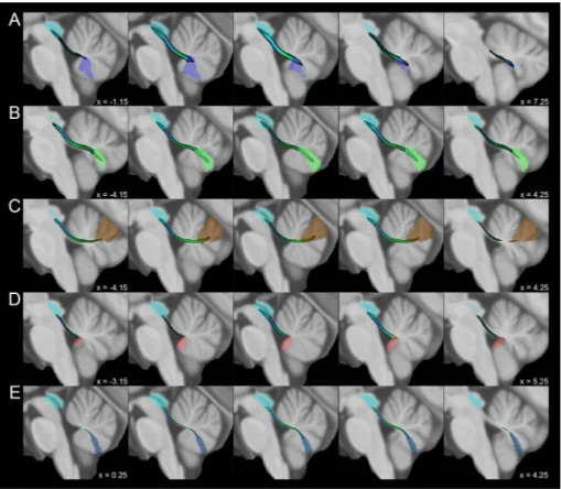Fig. 3    Average track density  maps showing tracts connecting  cerebellar vermal regions and  periaqueductal grey mapped  in directionally encoded color  space (DEC) and superimposed  to the MNI152 template
