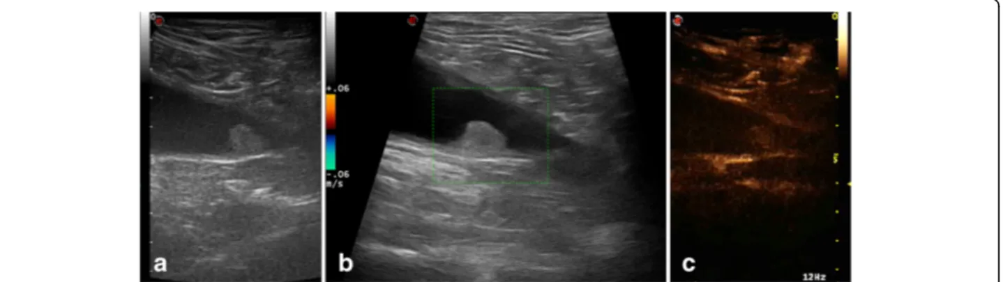 Fig. 2 9 year-old entire female mixed breed dog with nonpedunculated round shaped mass, located at the level of the bladder trigone