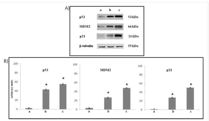 Figure 10: (A) Representative Western Blots and (B) semiquantitative analyses of p53, MDM2, p21 expression levels in total cellular lysates of