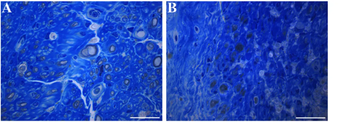 Figure 1 Representative high resolution light microscopic images of toluidine-blue-stained transverse sections of median nerve 36 weeks  after end-to-side coaptation with N-butyl-2-cyanoacrylate