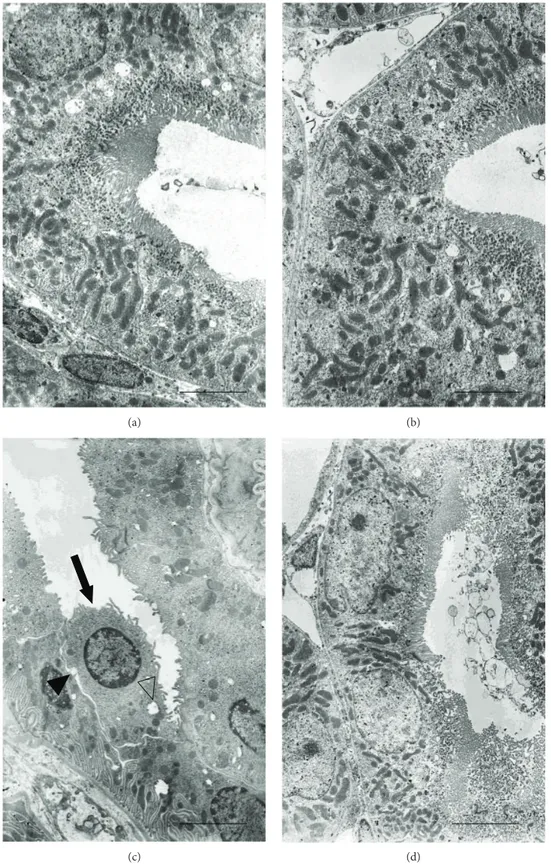 Figure 6: Ultrastructural organization of the proximal tubules of kidneys from mice of control plus vehicle (0.9% NaCl, 1 ml/kg/day i.p.), control plus ﬂavocoxid (20 mg/kg/day i.p.), CdCl 2 (2 mg/kg/day i.p.) plus vehicle, and CdCl 2 plus ﬂavocoxid groups