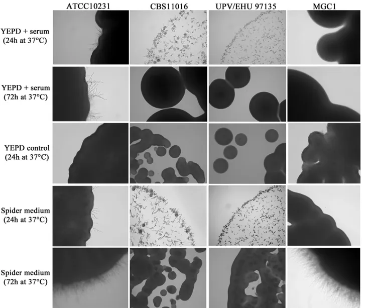 Fig 2. Microscopic characteristics of C. albicans and C. africana isolates grown on YEPD plus 10% serum and Spider medium at 37°C for 24 and 72h